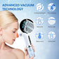 Electric Blackhead Remover – Your Ultimate Solution for Clear and Radiant Skin