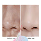 4-in-1 Acne Spot Electrotherapy Facial Wand