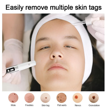 Skin Tag Remover Laser Plasma Pen Dark Spot Mole Wart Remover Pen Electric Tattoo Freckle Nevus Black Spots Skin Tag Removal